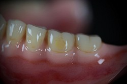 Műfog individualiz&aacute;l&aacute;s